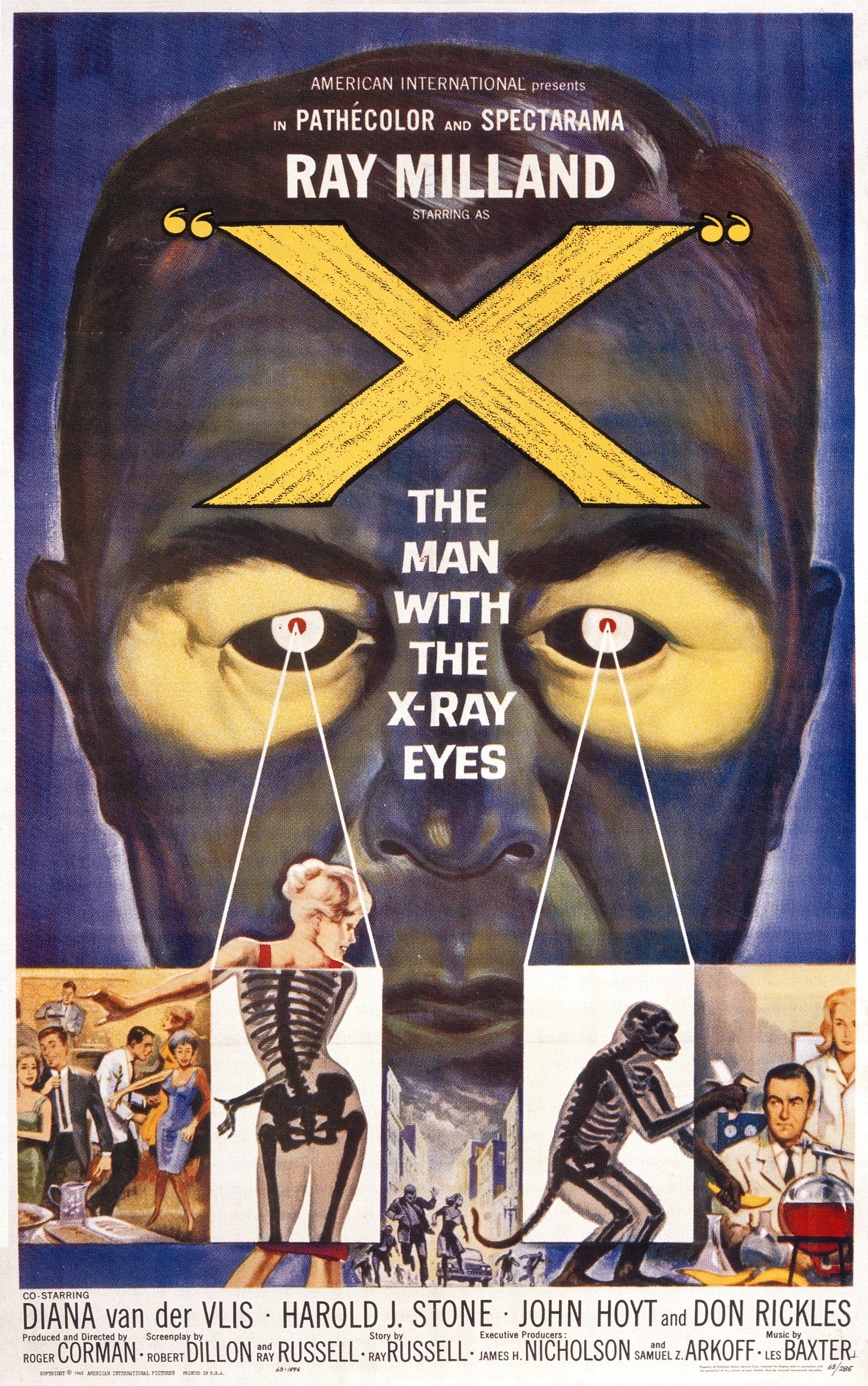 x_the_man_with_the_xray_eyes_xxlg